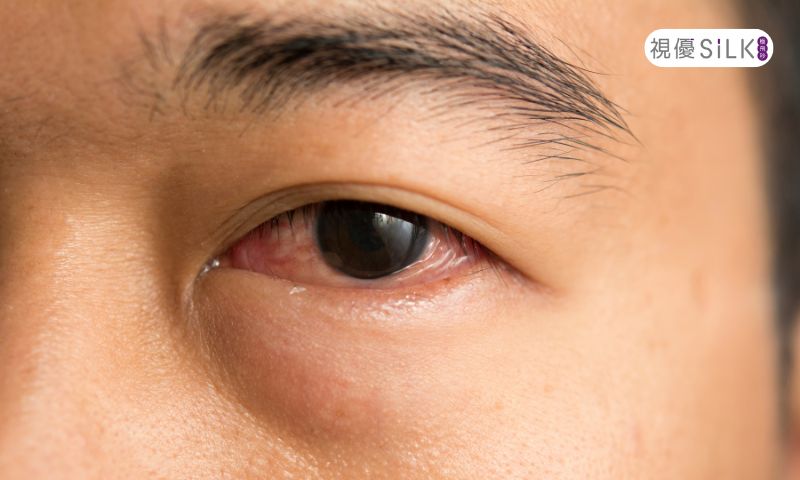 角膜神經很重要 角膜神經很重要