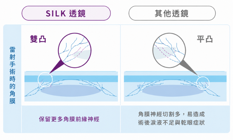 專利雙凸透鏡降低近視雷射術後乾眼
